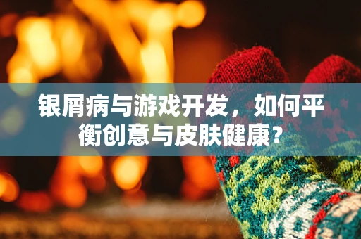 银屑病与游戏开发，如何平衡创意与皮肤健康？